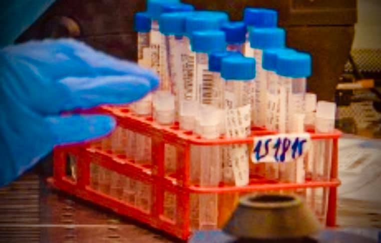 כללית מחוז צפון מודיעה על התחלת מבצע חיסונים כנגד וירוס הקורונה