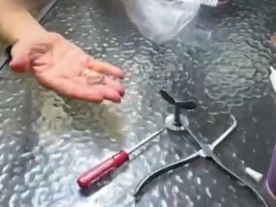 חבר: טבעת נתקעה באצבעה של אישה, וחולצה ע״י מתנדב ידידים