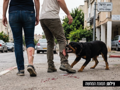 אירוע נשיכת הכלב בעפולה עלית: שני פצועים מטופלים במחלקה לרפואה דחופה בהעמק